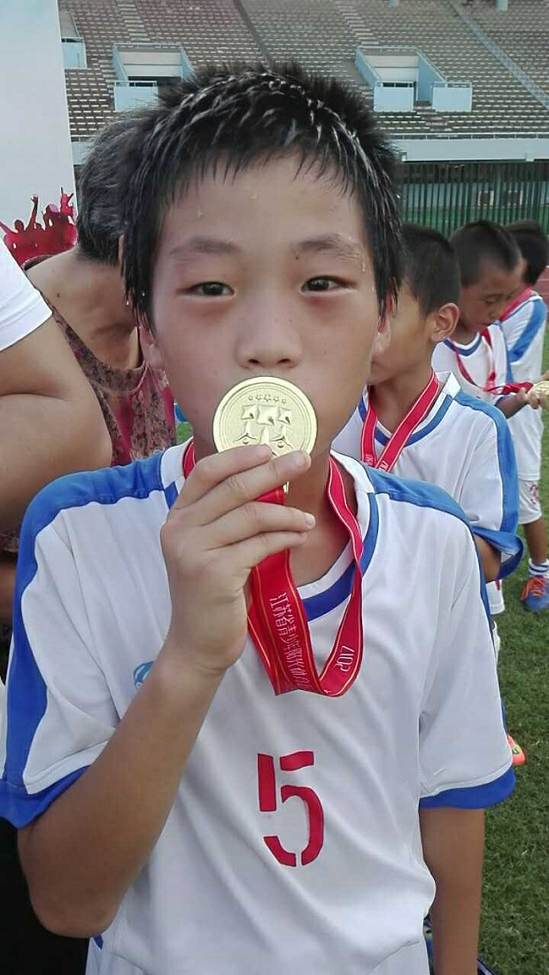 1503667794161541.png CD34102C32CFA082F078297760FFE248.png